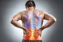 Chronic Back Pain